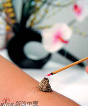 節(jié)氣灸” 冬至，你灸了嗎？