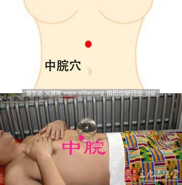 中脘穴位于腹部正中線，臍上4寸的位置上。每天艾灸10-15分鐘，能有效緩解胃部不適的癥狀，同時(shí)有助于祛濕。